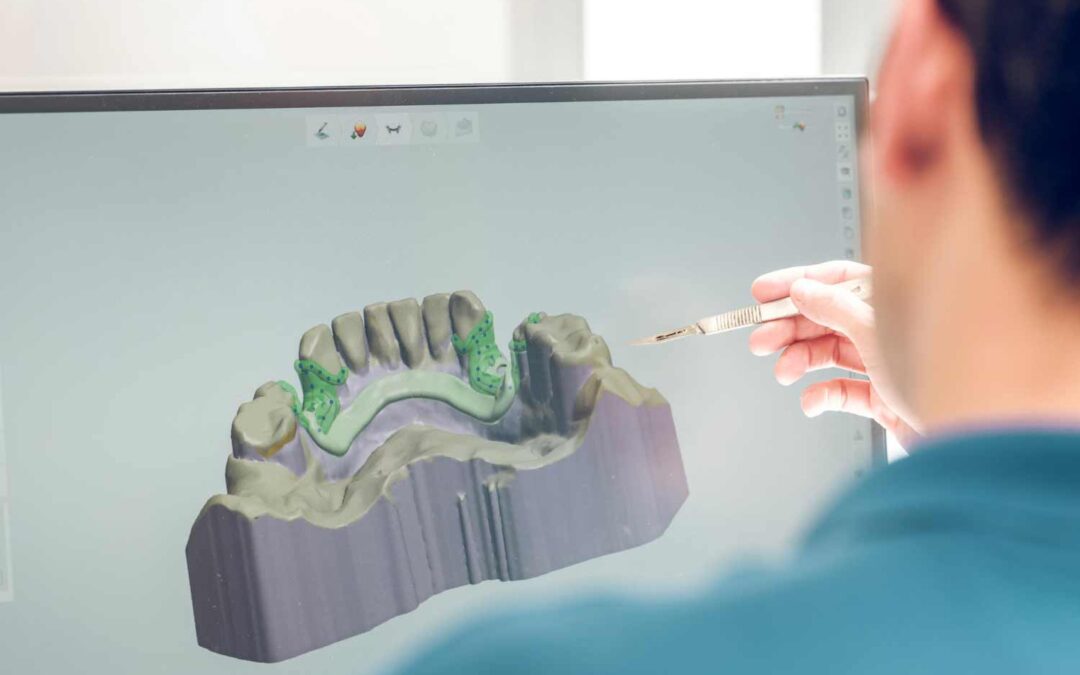 Tecnología CAD-CAM en Vitoria: Revolución en la Fabricación de Prótesis Dentales