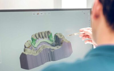 Tecnología CAD-CAM en Vitoria: Revolución en la Fabricación de Prótesis Dentales