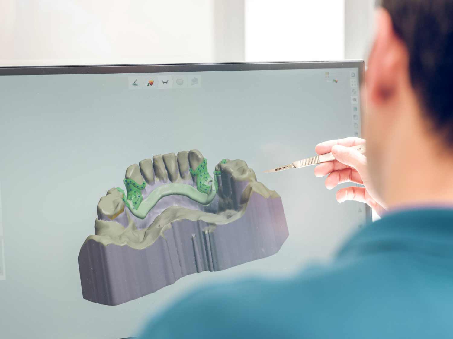 tecnologia-cad-cam-laboratorio-dental-vitoria