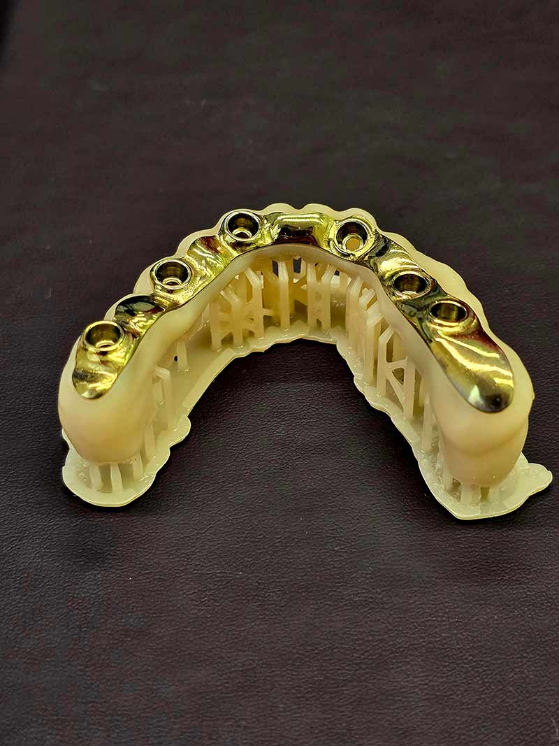 dentumlab-laboratorio-dental